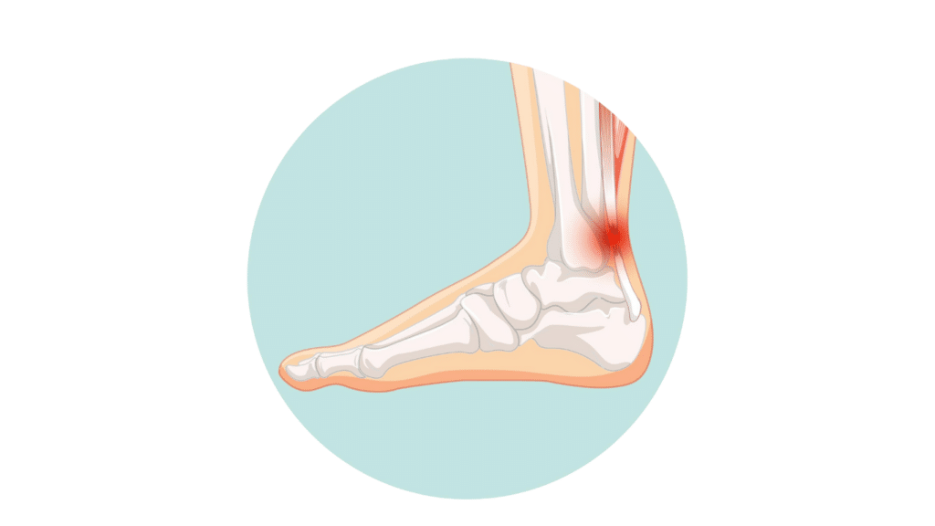 Sprunggelenksluxation Orthopäde Wien