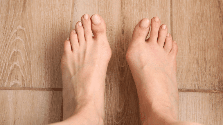 Fußerkrankungen Hallux Valgus und Hallux Rigidus im Vergleich