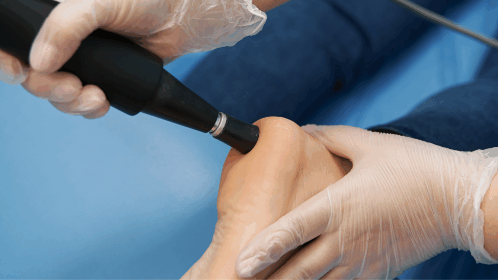 Stoßwellentherapie am Fuß als effektive Methode um Schmerzen zu lindern