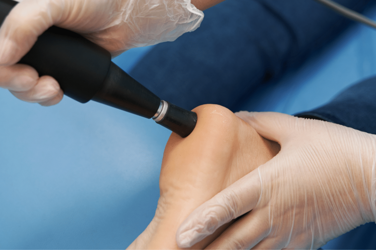 Stoßwellentherapie am Fuß als effektive Methode um Schmerzen zu lindern