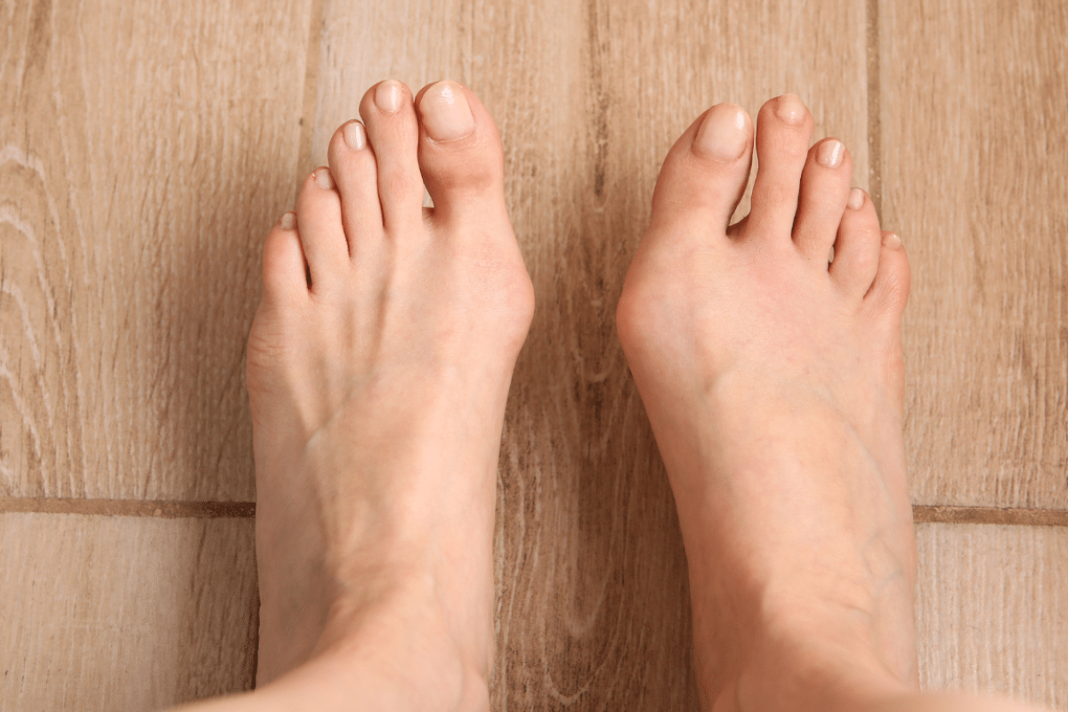 Fußerkrankungen Hallux Valgus und Hallux Rigidus im Vergleich